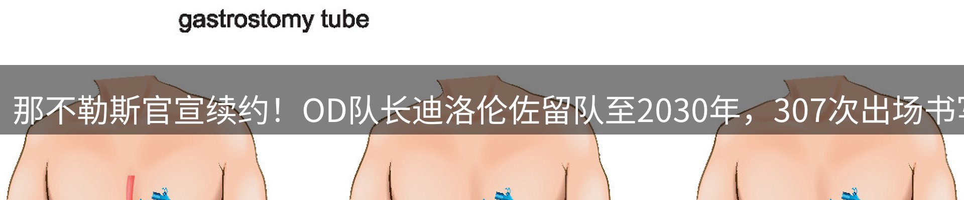 新闻报道